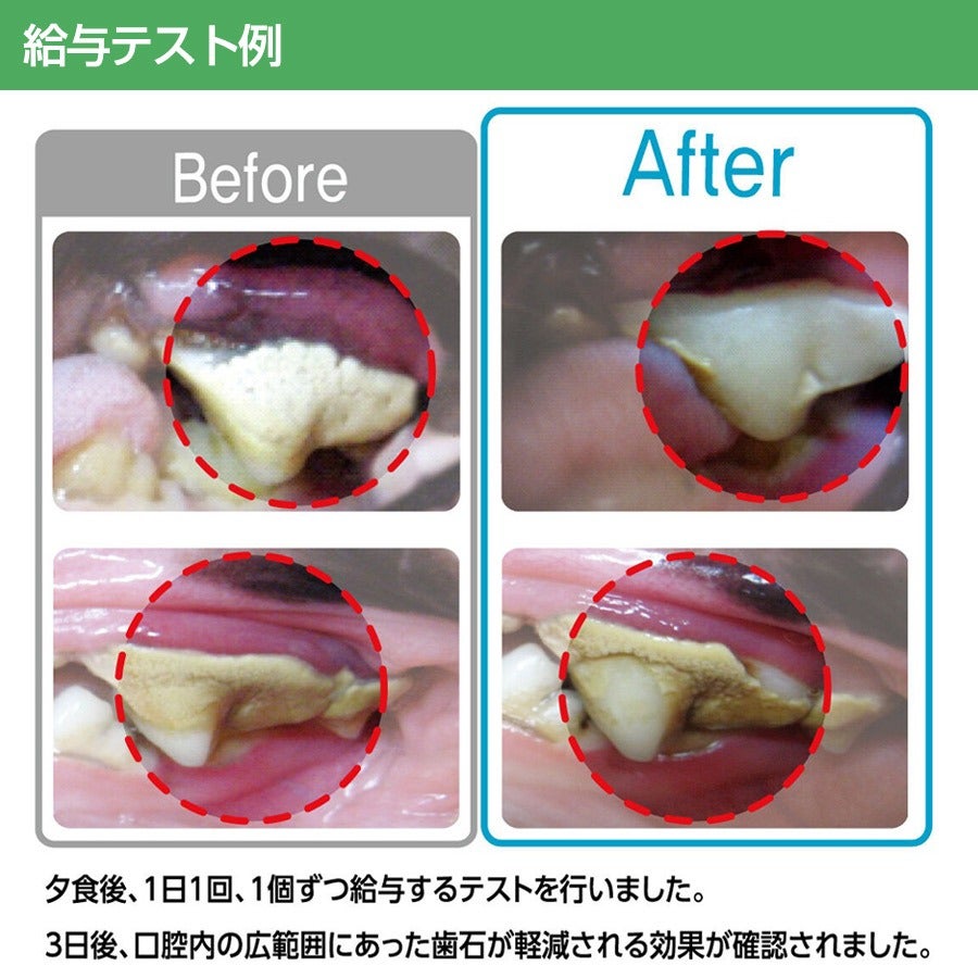 デンタルマルチメディア歯の健康ガイド リーフレット】歯の予防シリーズ(9) 酸蝕歯| 歯科総合出版社 デンタル